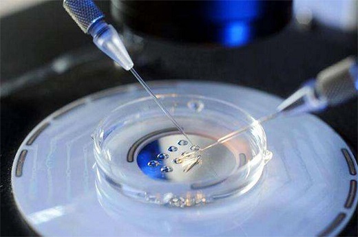 试管婴儿 如何筛选精子，二代试管怎样筛选精子