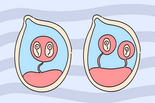 移植后拉肚子太多可以用这些方法帮忙缓解，早点使用早点舒坦
