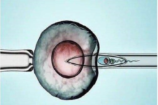 试管婴儿胚胎d3是什么