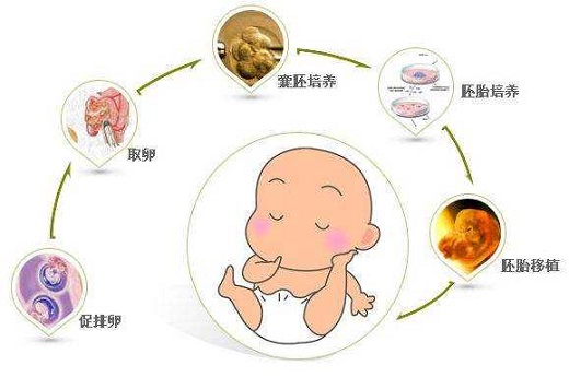 萍乡试管婴儿流程步骤