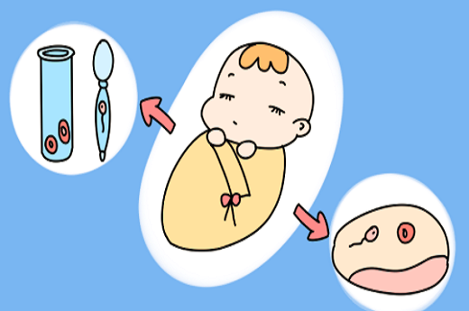 柳州试管婴儿的具体流程