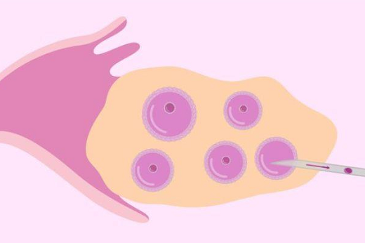 来宾第三代试管婴儿，第三代试管婴儿期间囊胚是怎么培养的