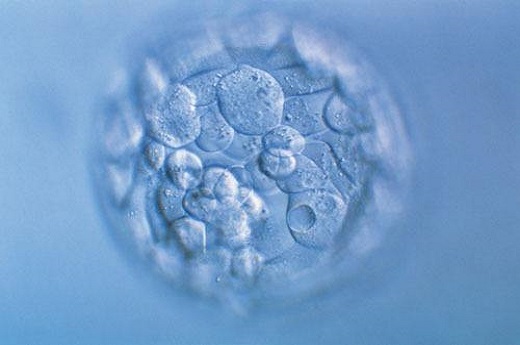 子宫异位怎么检查出来，子宫内膜异位症怎么检查出来的