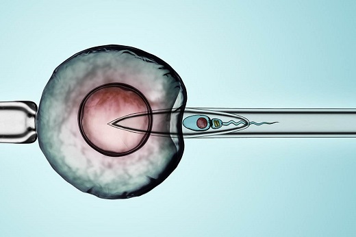 子宫内膜异位容易 胎停 为什么8周9周容易胎停